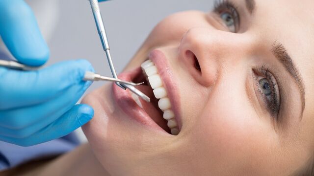 Jak optymalnie planować leczenie zębów bez niespodzianek finansowych?